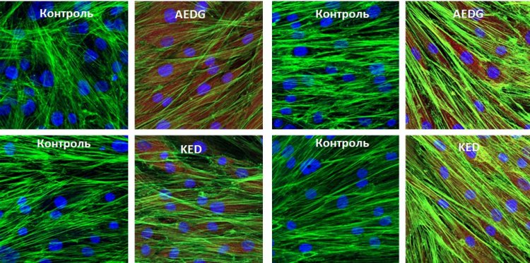 Фото предоставлено лабораторией В.Х. Хавинсона